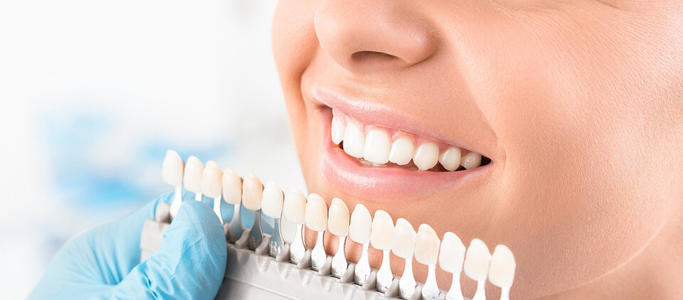 dentist-holding-up-porcelain-dental-veneers-to-compare-with-womans-teeth