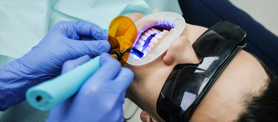 guy-receiving-professional-teeth-whitening-treatment