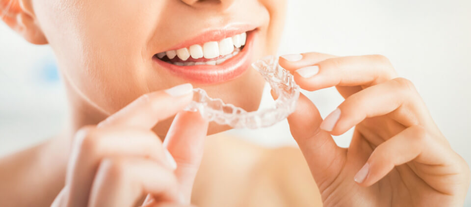 woman-putting-in-her-invisalign-aligner