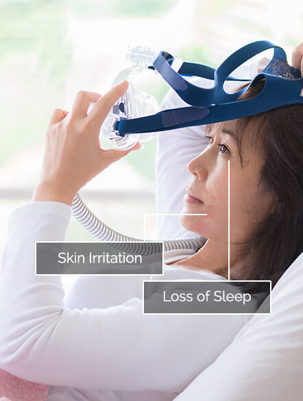 woman-placing-cpap-on-face-labeled-skin-irritation-and-loss-of-sleep